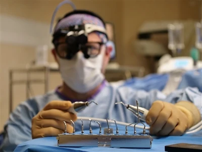 Fundamentele principes en ontwerpevolutie van micronaaldtechnologie